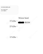 Anti-RGS4 Rabbit pAb servicebio GB114777-100