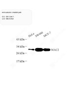 Anti-Galectin 3 Rabbit pAb servicebio GB11246-1-100