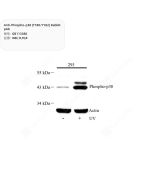 Anti-Phospho-p38 (T180/Y182) Rabbit pAb servicebio GB113380-100