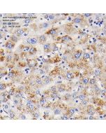 Anti-Transferrin Receptor 2/TFR2 Rabbit pAb servicebio GB113731-50