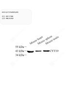 Anti-Cyt 19 Rabbit pAb servicebio GB111580-100