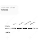 Anti-VEGF Receptor 1 Rabbit pAb servicebio GB114200-50