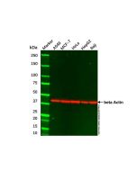 A549 Whole Cell Lysate cl155906-200μg Aladdin