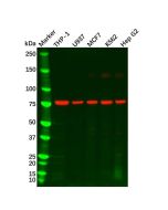GCSF Receptor Antibody - Primary antibody, specific to CSF3R, Rabbit IgG Ab105080-10μl Aladdin
