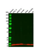 IL22 Mouse mAb Ab110155-10μl Aladdin