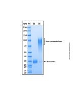 Recombinant Human Noggin Protein rp149360-10μg Aladdin