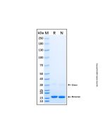 Recombinant Human DUSP19 Protein rp189416-10μg Aladdin