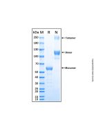 Recombinant Human RANK/TNFRSF11A Protein rp150852-10μg Aladdin