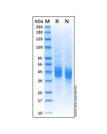 Recombinant Bovine CD4 Protein rp175916-10μg Aladdin