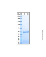 Recombinant Human Serpin E2/PN1 Protein rp151441-10μg Aladdin