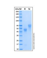 Recombinant Human Coagulation Factor Xa Protein rp184033-10μg Aladdin