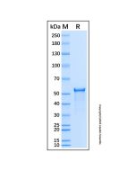 Recombinant Human FZR1 Protein rp220447-10μg Aladdin