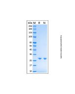 Recombinant Human Calretinin/CALB2 Protein rp189283-10μg Aladdin