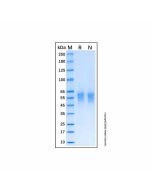 Recombinant Human DDR2 Protein rp188240-10μg Aladdin