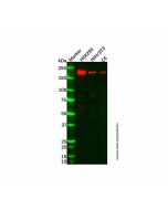 Recombinant ZEB1 Antibody - Primary antibody, specific to ZEB1, Rabbit IgG Ab135194-10μl Aladdin