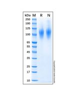 Recombinant Human CD68 Protein rp175904-10μg Aladdin