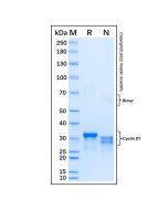 Recombinant Human Cyclin D1 Protein rp230937-10μg Aladdin