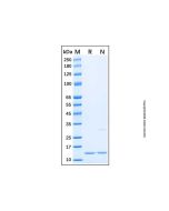 Recombinant Human MAP1LC3A Protein rp183742-10μg Aladdin