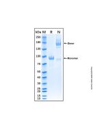 Recombinant Human Semaphorin 3C Protein rp151390-10μg Aladdin