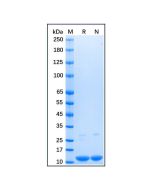 Recombinant Human Parvalbumin Protein rp156672-10μg Aladdin