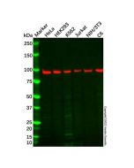 Recombinant CDT2/RAMP Antibody - Primary antibody, specific to Recombinant CDT2/RAMP, Rabbit IgG Ab095882-10μl Aladdin