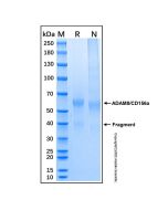 Recombinant Human ADAM8/CD156a Protein rp148962-10μg Aladdin