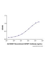 Recombinant Human IGFBP-rp1/IGFBP-7 Protein rp181562-10μg Aladdin