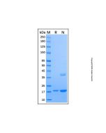 Recombinant Human dUTPase Protein rp188377-10μg Aladdin