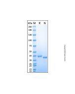 Recombinant Mouse sFRP-3 Protein rp168496-10μg Aladdin