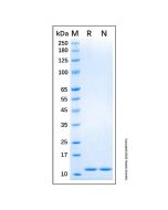 Recombinant Human S100A4 Protein rp183701-10μg Aladdin