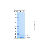Recombinant Human PF4V1 Protein rp232396-10μg Aladdin