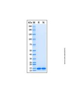 Recombinant Human Cdc26 / Apc12 Protein rp189301-10μg Aladdin