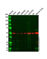 Recombinant Integrin Linked ILK Antibody - Primary antibody, specific to ILK, Rabbit IgG Ab110922-10μl Aladdin