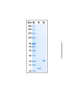 Recombinant Human CCL24/Eotaxin-2/MPIF-2 Protein rp181317-10μg Aladdin