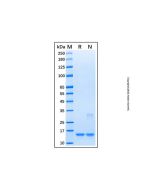Recombinant Human/Mouse/Rat UbcH5c/UBE2D3 Protein rp179796-10μg Aladdin