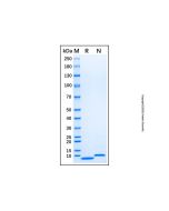 Recombinant Human CXCL3/GRO gamma Protein rp181572-10μg Aladdin