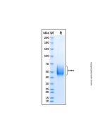 Recombinant Human L-Selectin/CD62L Protein rp183639-10μg Aladdin