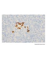 Recombinant Somatostatin Antibody - Primary antibody, specific to Recombinant Somatostatin, Rabbit IgG Ab128660-10μl Aladdin