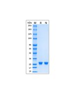 Recombinant EN-TEV Protease Protein rp156465-1KU Aladdin