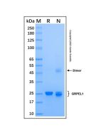 Recombinant Human GRPEL1 Protein rp192123-10μg Aladdin