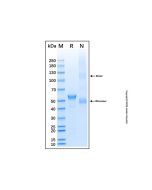 Recombinant Human c-Myc Protein rp214397-10μg Aladdin