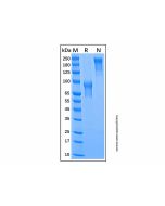 Recombinant Mouse IL-15R alpha Protein rp168266-10μg Aladdin