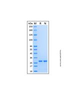 Recombinant Human DCUN1D2 Protein rp188370-10μg Aladdin