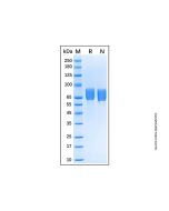 Recombinant Human Vanin-1/VNN1 Protein rp153200-10μg Aladdin