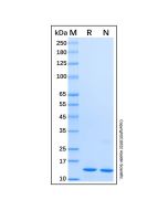 Recombinant Human FABP4 Protein rp184123-10μg Aladdin