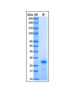 Recombinant Human p27 KIP 1 Protein rp176706-10μg Aladdin