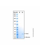 Recombinant Human IL-32 alpha Protein rp147557-10μg Aladdin