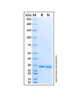 Recombinant Human RPS4X Protein rp192224-10μg Aladdin