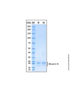 Recombinant Mouse IL-10 Protein rp154124-10μg Aladdin