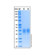 Recombinant human CD48 protein rp144040-10μg Aladdin